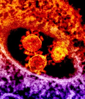 Coronavirus: misure urgenti per evitare la diffusione